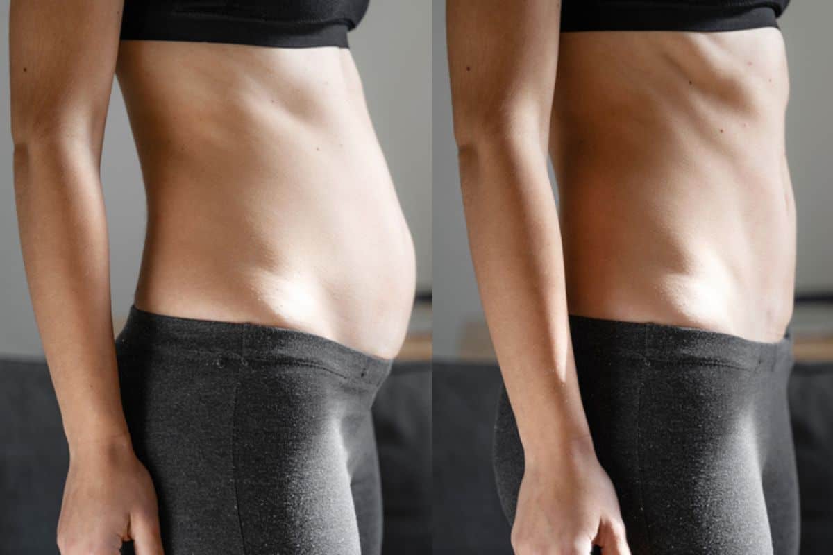 Post-Pregnancy: What Happens to Your Abdominal Muscles After Birth East Bedfont