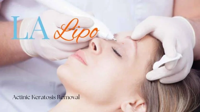 Woman receiving Actinic Keratosis Removal Treatment East Bedfont