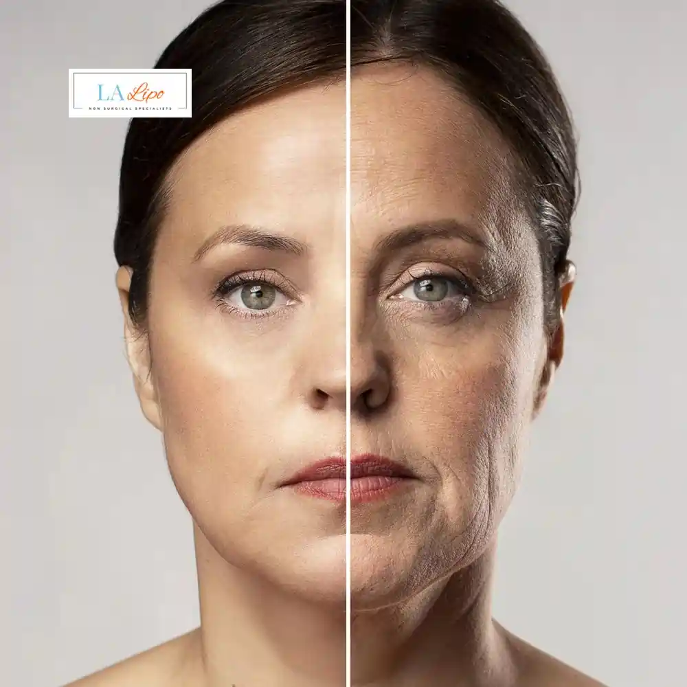How Can You Tell If Non-Surgical Skin Tightening Is Right for You East Bedfont?