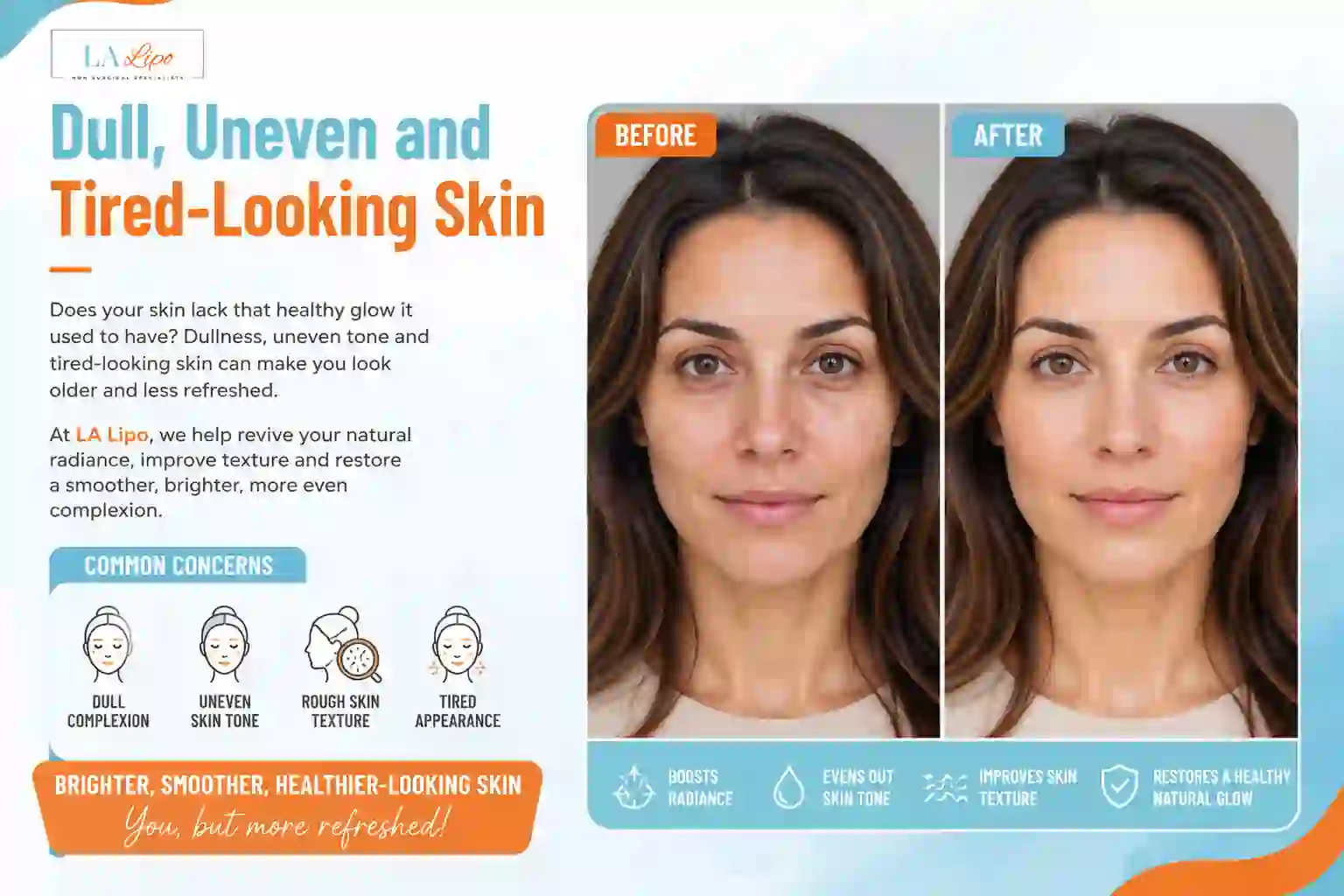 Sign #5: Dull, Uneven and Tired-Looking Skin East Bedfont