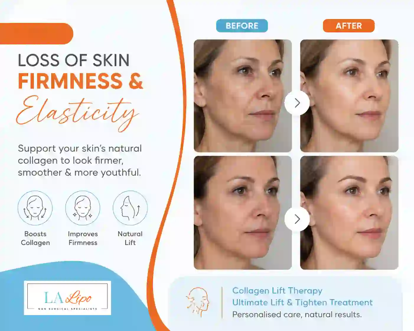 Sign #7: Loss of Skin Firmness and Elasticity East Bedfont