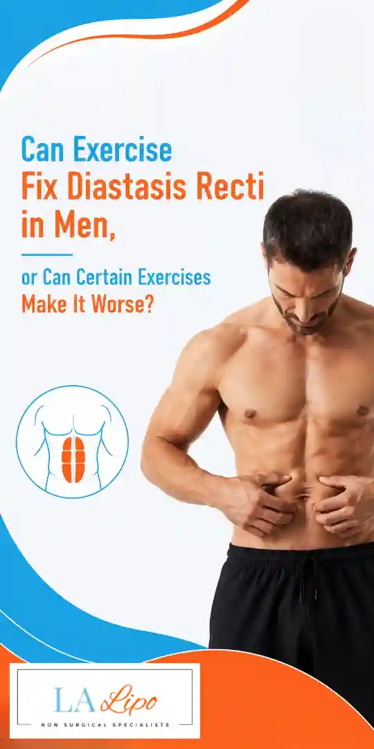 Can Exercise Fix Diastasis Recti in Men, or Can Certain Exercises Make It Worse East Bedfont?